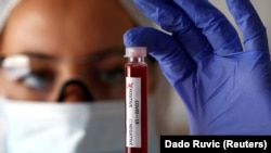 În ultimele 24 de ore au fost prelucrate 12.649 de teste RT-PCR și 4.930 de teste rapide antigenice.