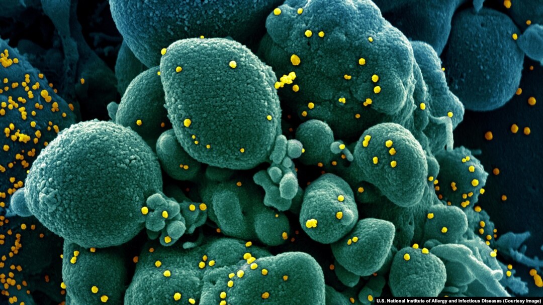 imagine la microscopul electronic cu coronavirus (în galben)